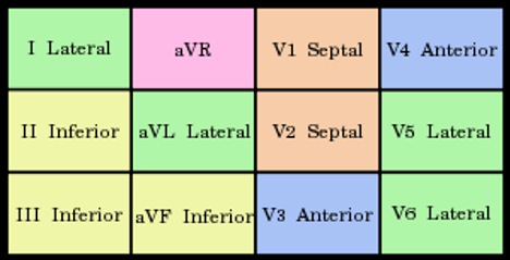 Lead Correspondence to Heart Areas