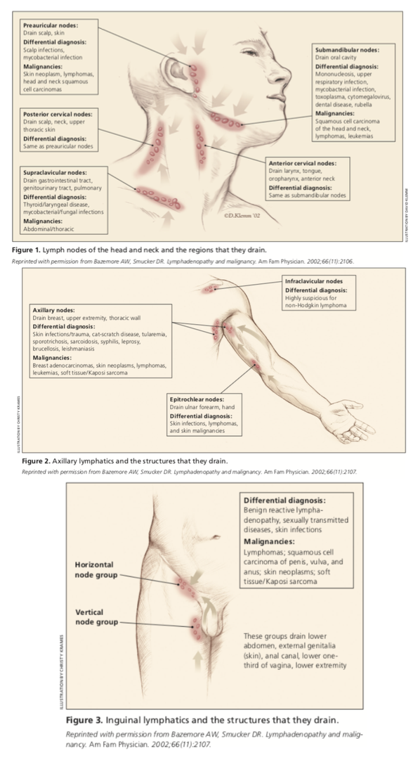 View Preauricular Lymph Nodes Swollen Pics