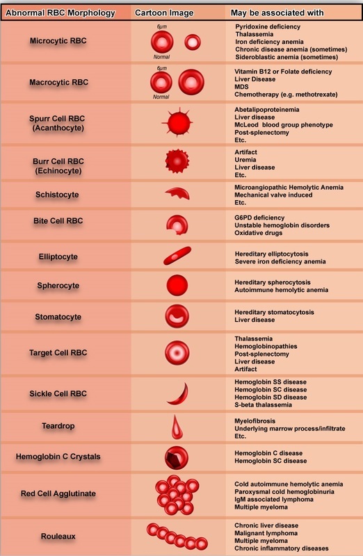 Normocytic Anemia Medgeeks